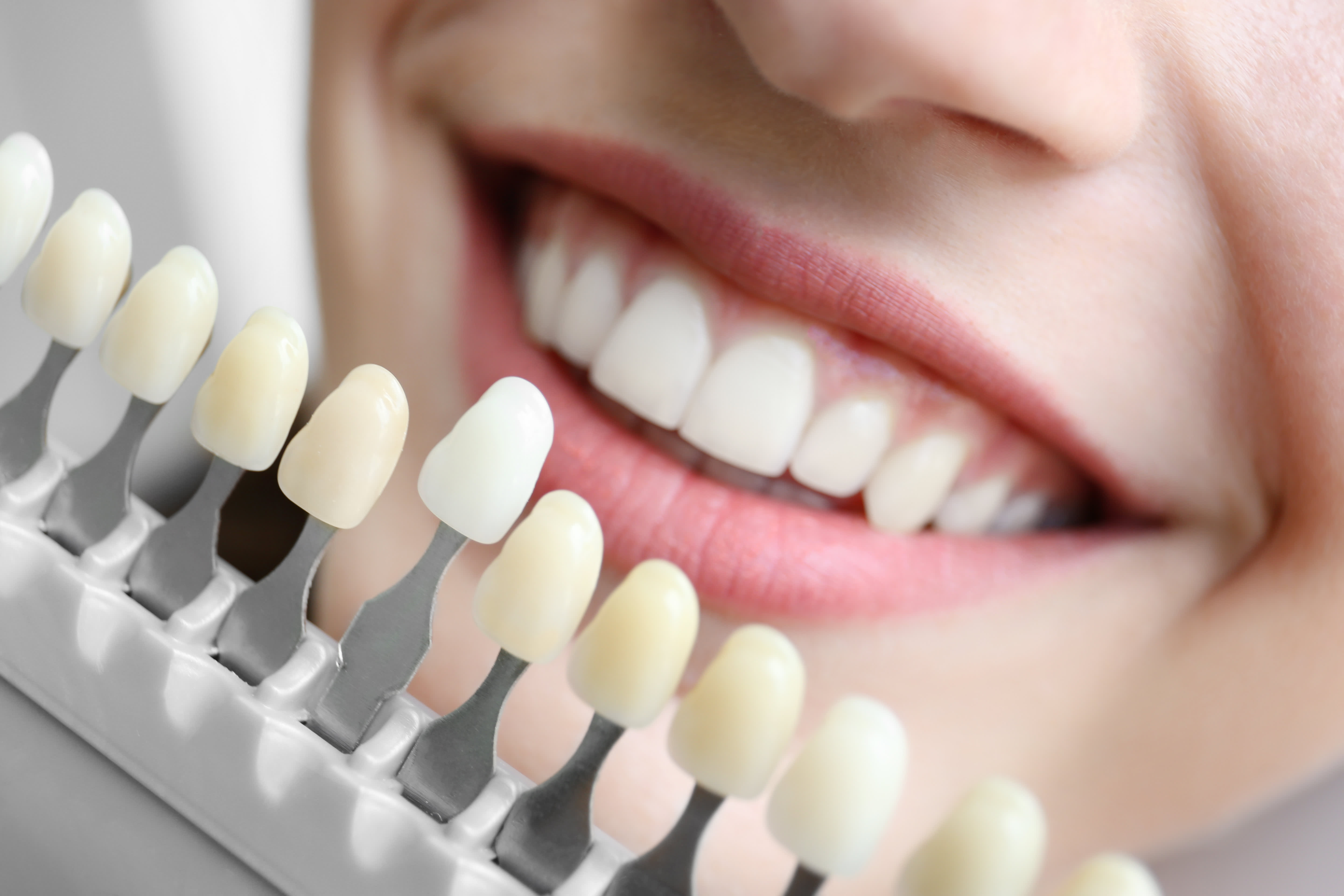 Dental Implants